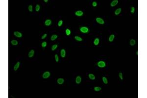 Immunofluorescence staining of Hela Cells with ABIN7127442 at 1:50, counter-stained with DAPI.