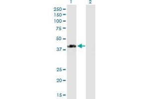 Western Blot analysis of SPG11 expression in transfected 293T cell line by SPG11 MaxPab polyclonal antibody. (SPG11 anticorps  (AA 1-425))