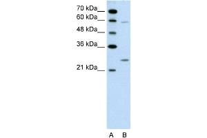 WB Suggested Anti-GAMT Antibody Titration:  0. (GAMT anticorps  (N-Term))