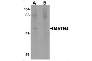 Western blot analysis of MATN4 in rat brain tissue lysate with this product at 1 μg/ml in (A) the absence and (B) the presence of blocking peptide. (MATN4 anticorps  (N-Term))