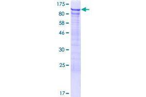 Image no. 1 for DEAD (Asp-Glu-Ala-Asp) Box Polypeptide 42 (DDX42) (AA 1-819) protein (GST tag) (ABIN1351358)