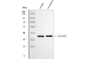 Western blot analysis of SFXN5 using anti-SFXN5 antibody (ABIN7601388). (Sideroflexin 5 anticorps  (AA 34-340))