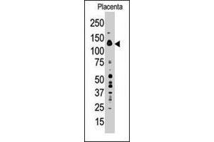 Western blot analysis of PTPN21 polyclonal antibody  in placenta tissue lysate (35 ug/lane).