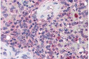 Human Spleen (formalin-fixed, paraffin-embedded) stained with KPNB1 antibody ABIN337256 at 5 ug/ml followed by biotinylated anti-goat IgG secondary antibody ABIN481715, alkaline phosphatase-streptavidin and chromogen. (KPNB1 anticorps  (AA 851-863))