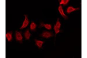 anti-Ezrin (EZR) (C-Term) antibody
