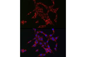 Immunofluorescence analysis of PC-12 cells using HB-EGF Rabbit pAb (ABIN6130449, ABIN6141644, ABIN6141645 and ABIN6218793) at dilution of 1:150 (40x lens). (HBEGF anticorps  (AA 20-160))