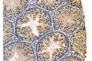 ABIN6265384 and ABIN6278405 at 1/100 staining Mouse testis tissue by IHC-P.