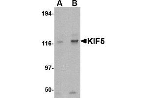 Western Blotting (WB) image for anti-Kinesin Family Member 5A (KIF5A) (Middle Region) antibody (ABIN1030974)