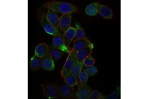 Immunofluorescence analysis of Hela cells using CD59 antibody (green). (CD59 anticorps  (AA 31-111))