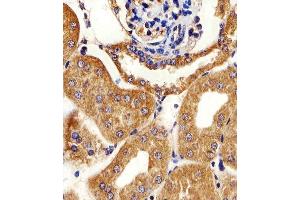 Immunohistochemical analysis of paraffin-embedded M. (AK4 anticorps  (AA 119-153))