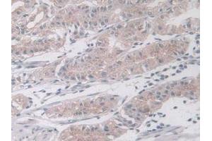 IHC-P analysis of Human Liver Tissue, with DAB staining. (MAPK12 anticorps  (AA 27-311))