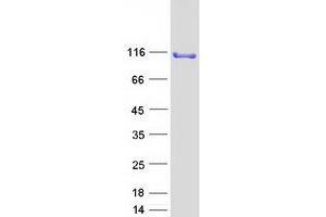 Validation with Western Blot