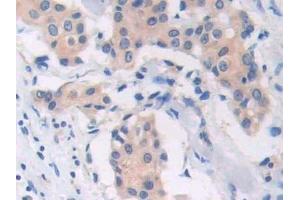 anti-CAP, Adenylate Cyclase-Associated Protein 1 (CAP1) (AA 33-218) antibody