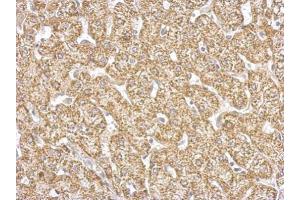 IHC-P Image GOT2 antibody detects GOT2 protein at cytosol on human hepatoma by immunohistochemical analysis.
