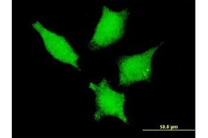 Immunofluorescence of monoclonal antibody to DDX20 on HeLa cell. (DDX20 anticorps  (AA 725-824))