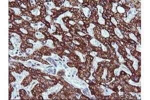 anti-Zinc Finger and SCAN Domain Containing 21 (Zscan21) antibody