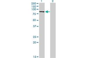 Western Blot analysis of DLG3 expression in transfected 293T cell line by DLG3 monoclonal antibody (M03), clone 2B6.