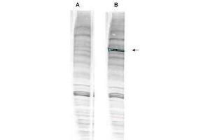 Western blot analysis is shown using  anti-Human WHIP antibody with and without pre-incubation with blocking peptide. (WRNIP1 anticorps  (Internal Region, Isoform 1, Isoform 2))
