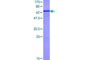 Image no. 1 for Spermine Synthase, SMS (SMS) (AA 1-366) protein (GST tag) (ABIN1320714)