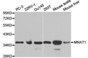 Western Blotting (WB) image for anti-Menage A Trois Homolog 1, Cyclin H Assembly Factor (Xenopus Laevis) (MNAT1) antibody (ABIN1873734) (MNAT1 anticorps)