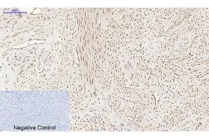 anti-Platelet Derived Growth Factor Subunit B (PDGFB) (AA 30-110) antibody