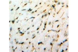 Used in DAB staining on fromalin fixed paraffin-embedded Heart tissue