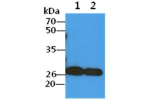 The Cell lysates (40ug) were resolved by SDS-PAGE, transferred to PVDF membrane and probed with anti-human COMMD7 antibody (1:1000).