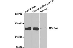 Western blot analysis of extracts of various cell lines, using COL1A2 antibody. (COL1A2 anticorps)