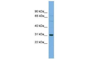 Western Blot showing SLCO1B1 antibody used at a concentration of 1-2 ug/ml to detect its target protein. (SLCO1B1 anticorps  (Middle Region))