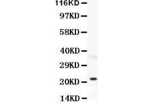 Anti-Bid antibody, Western blotting All lanes: Anti Bid at 0. (BID anticorps  (C-Term))