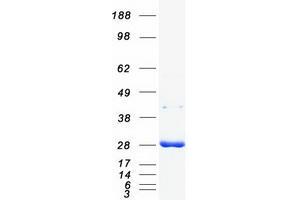 Validation with Western Blot