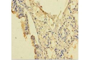 Immunohistochemistry of paraffin-embedded human lung tissue using ABIN7168126 at dilution of 1:100