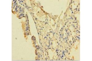 Immunohistochemistry of paraffin-embedded human lung tissue using ABIN7168126 at dilution of 1:100 (RPP29 anticorps  (AA 1-220))