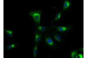 Immunofluorescent staining of A549 cells using anti-SOX17 mouse monoclonal antibody (ABIN2452377). (SOX17 anticorps  (AA 177-414))