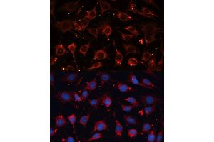 Immunofluorescence analysis of C6 cells using CASP3 antibody. (Caspase 3 anticorps  (AA 55-160))
