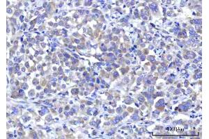 IHC analysis of RPS5 using anti-RPS5 antibody (ABIN7599076). (RPS5 anticorps  (AA 1-204))