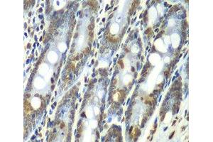 Immunohistochemistry of paraffin-embedded Rat Intestine using SEPT7 Polyclonal Antibody at dilution of 1:100 (40x lens). (Septin 7 anticorps)