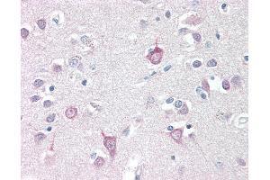 Anti-AP3B2 antibody IHC staining of human brain, cortex. (AP3B2 anticorps  (N-Term))