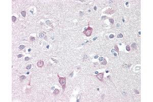 Anti-AP3B2 antibody IHC staining of human brain, cortex. (AP3B2 anticorps  (N-Term))