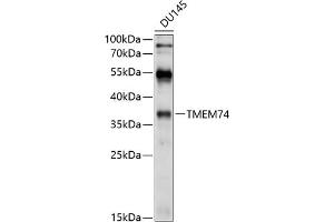 Western blot analysis of extracts of DU145 cells, using TMEM74 antibody (ABIN6131065, ABIN6149271, ABIN6149272 and ABIN6214614) at 1:1000 dilution.