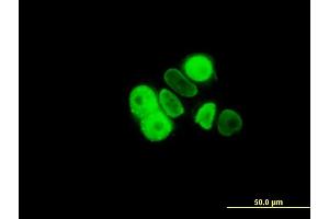 Immunofluorescence of monoclonal antibody to PGR on MCF-7 cell.