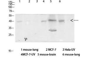 Western Blot (WB) analysis of specific cells using Antibody diluted at 1:1000. (beta Arrestin 1 anticorps  (Ser157))