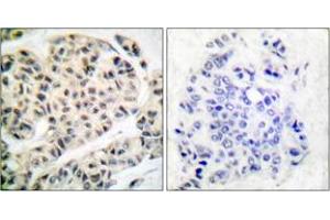 Immunohistochemistry (IHC) image for anti-Myocyte Enhancer Factor 2A (MEF2A) (pThr319) antibody (ABIN2888467) (MEF2A anticorps  (pThr319))