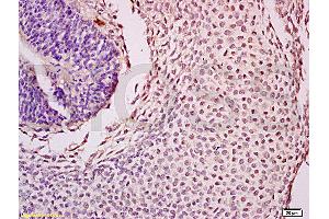 Formalin-fixed and paraffin embedded mouse tooth germ tissue labeled with Anti-Nanog Polyclonal Antibody (ABIN728758), Unconjugated at 1:200, followed by conjugation to the secondary antibody and DAB staining
