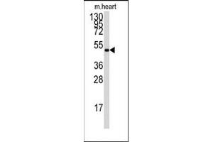 Image no. 2 for anti-Protein Kinase, AMP-Activated, gamma 1 Non-Catalytic Subunit (PRKAG1) (Middle Region) antibody (ABIN359117)
