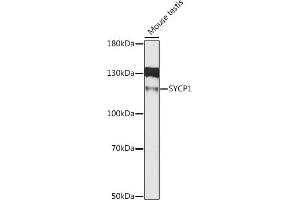 Western blot analysis of extracts of mouse testis, using SYCP1 antibody (ABIN6128702, ABIN6148758, ABIN6148759 and ABIN6215723) at 1:1000 dilution.