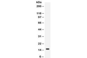 Western blot testing of human SW620 cell lysate with FABP2 antibody.