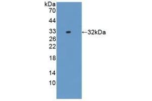 Detection of Recombinant IL17RD, Rat using Polyclonal Antibody to Interleukin 17 Receptor D (IL17RD) (IL17RD anticorps  (AA 356-605))