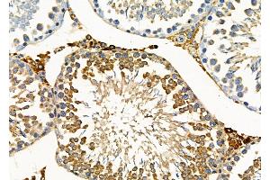 ABIN6263769 and ABIN6277767 at 1/100 staining Rat testis tissue by IHC-P.