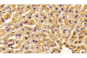 Detection of OT in Mouse Liver Tissue using Polyclonal Antibody to Preprooxytocin (OT) (OXT anticorps  (AA 20-124))